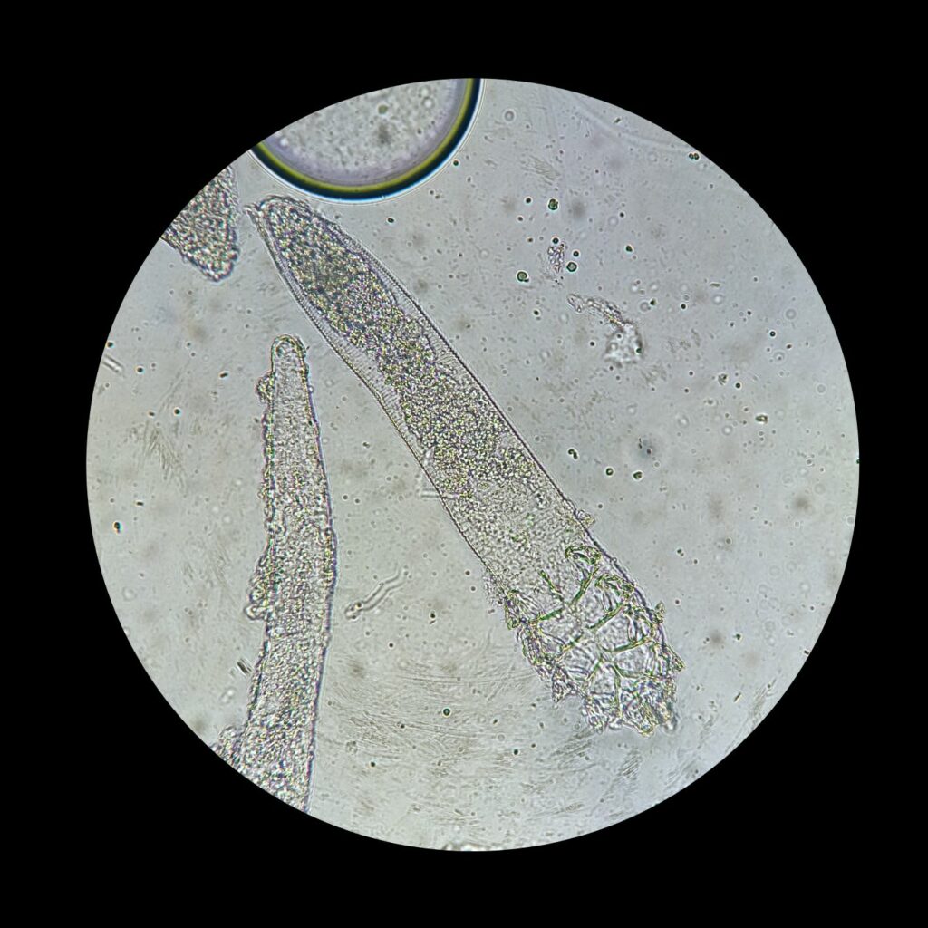Trudnici (roztoči Demodex) pod mikroskopem