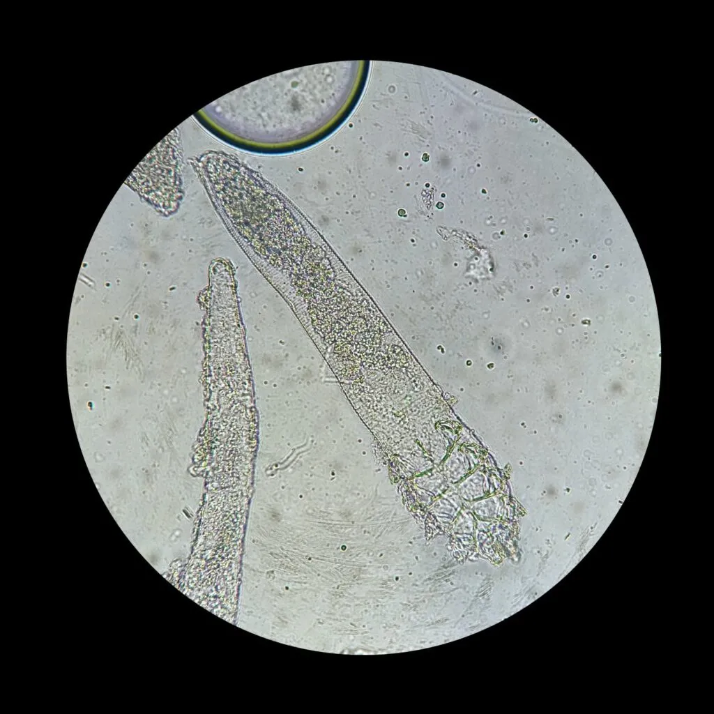 Trudnici (roztoči Demodex) pod mikroskopem